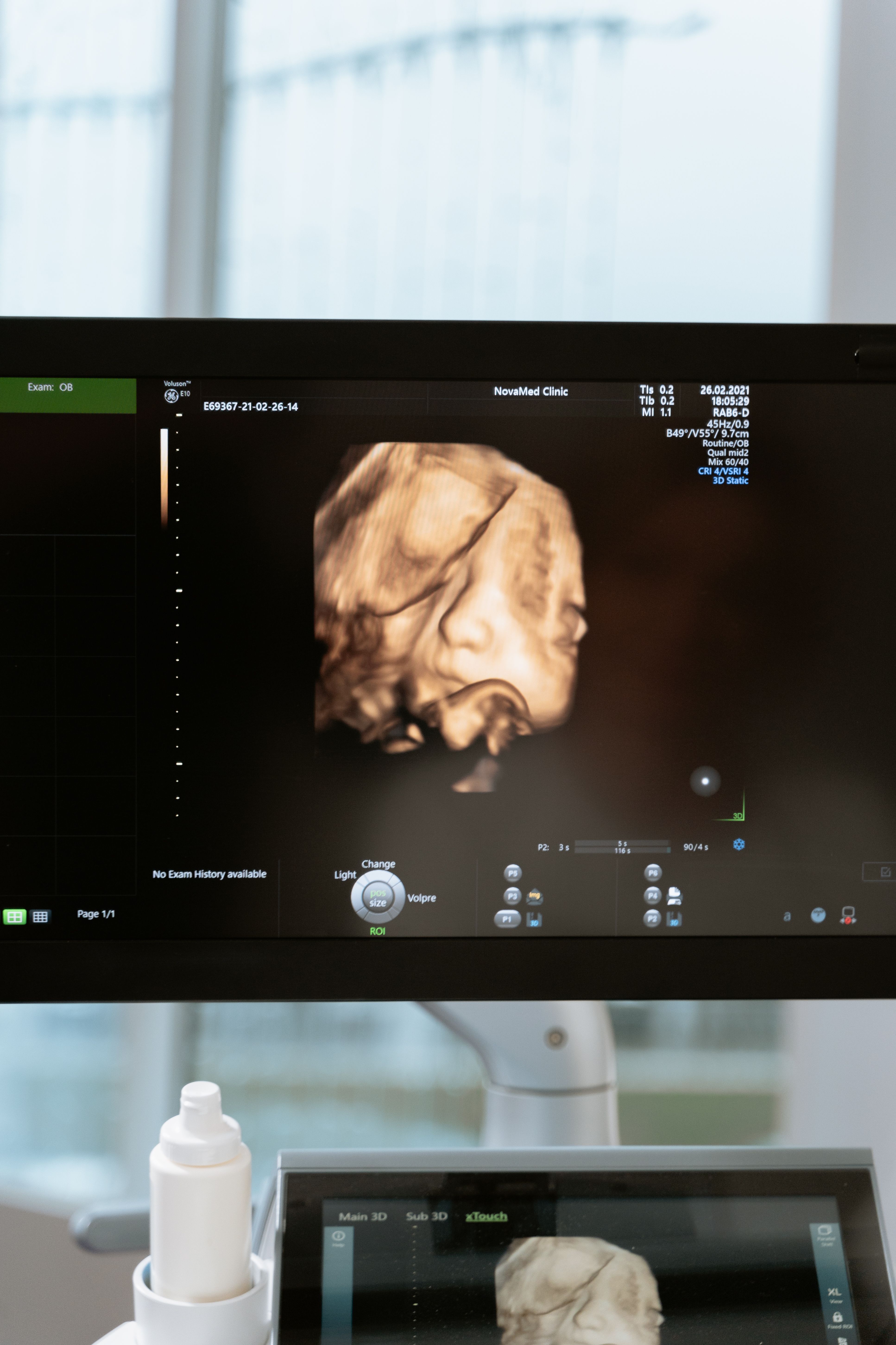3D ultrasound imaging on a clinical workstation